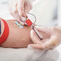 CORSO ACCESSI VASCOLARI SEMPLICI OMCEO VICENZA
